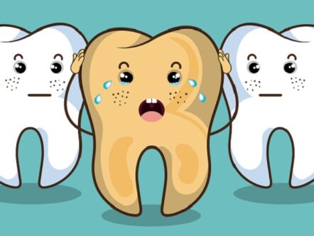 alimentos que escurecem os dentes